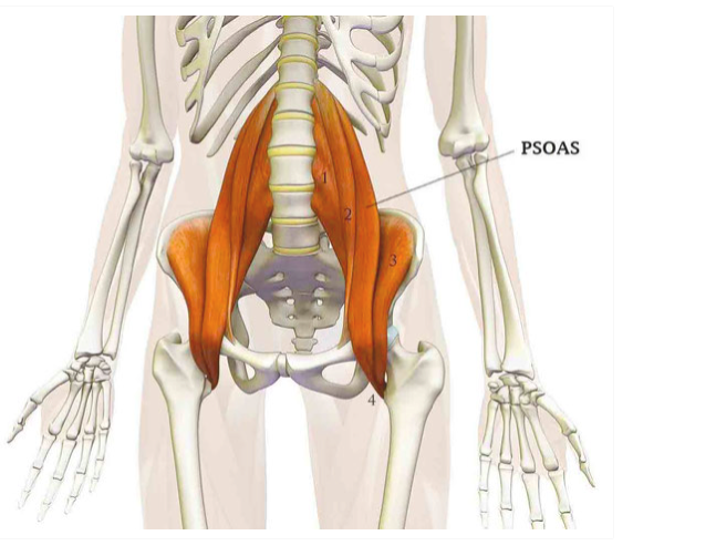 mal de dos psoas